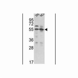 Thermo Fisher, Invitrogen, TMPRSS2 Polyclonal Antibody, EA, PA514264