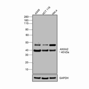 Thermo Fisher, ANNEXIN A2 ANTIBODY EA, PA527085