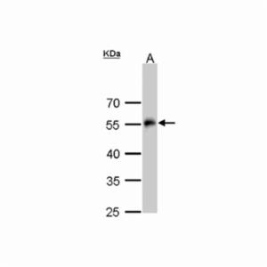 Thermo Fisher, ANTI-ALPHA TUBULIN 4A EA, PA529444