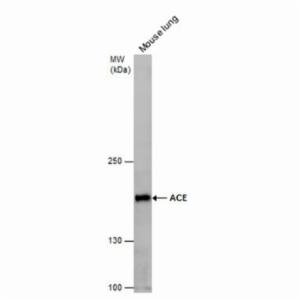 Thermo Fisher, ACE ANTIBODY 100 ul, PA585115