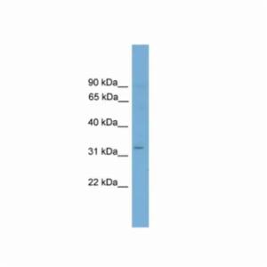 Thermo Fisher, ETV2 100 UL, PA568763 Thermo Fisher, ETV2 100 UL, PA568763