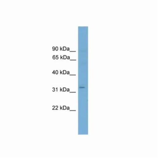 Thermo Fisher, ETV2 100 UL, PA568763