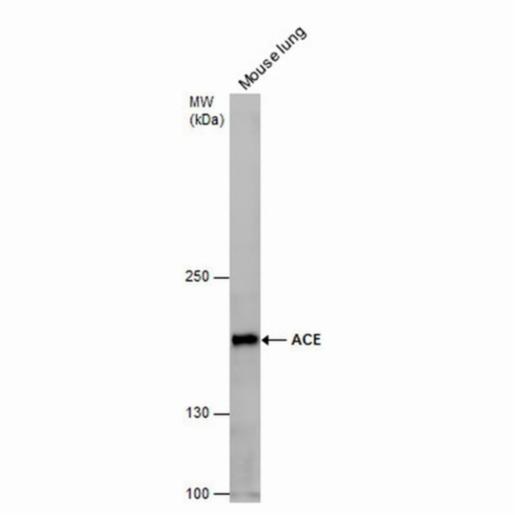 Thermo Fisher, ACE ANTIBODY 100 ul, PA585115